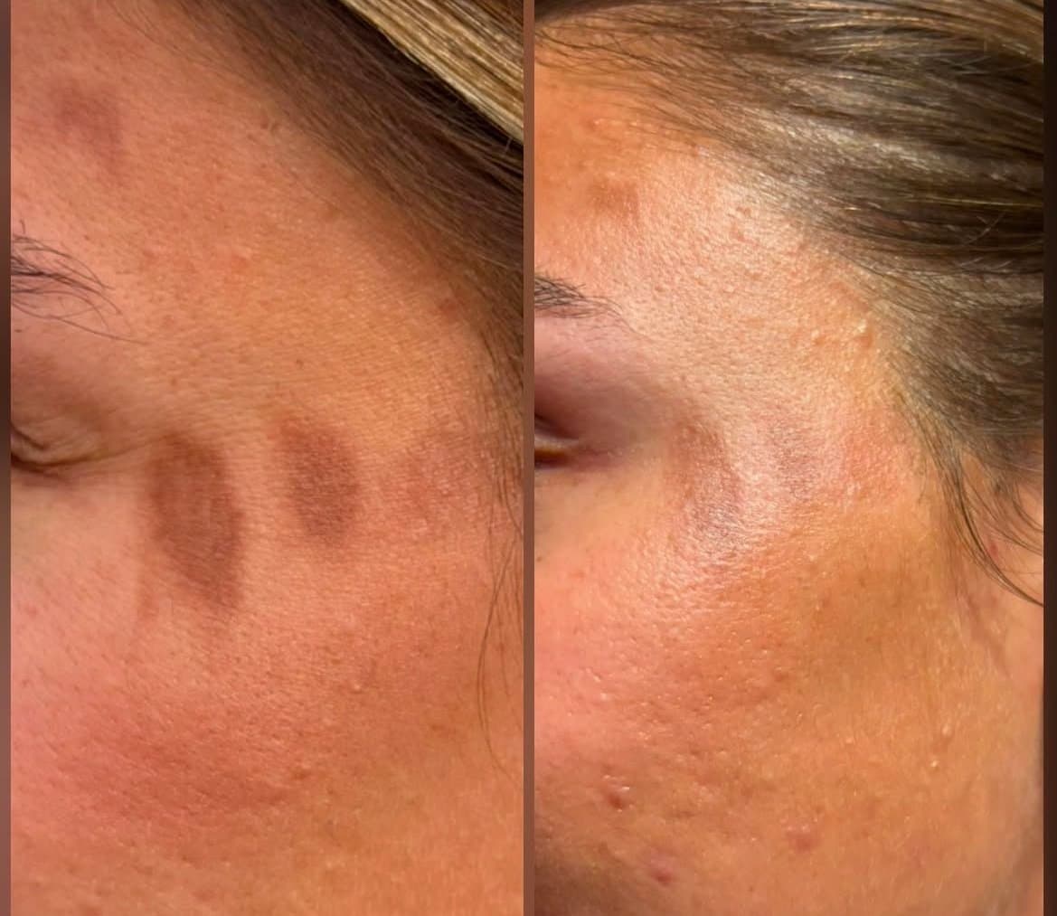 Refresh client result preview